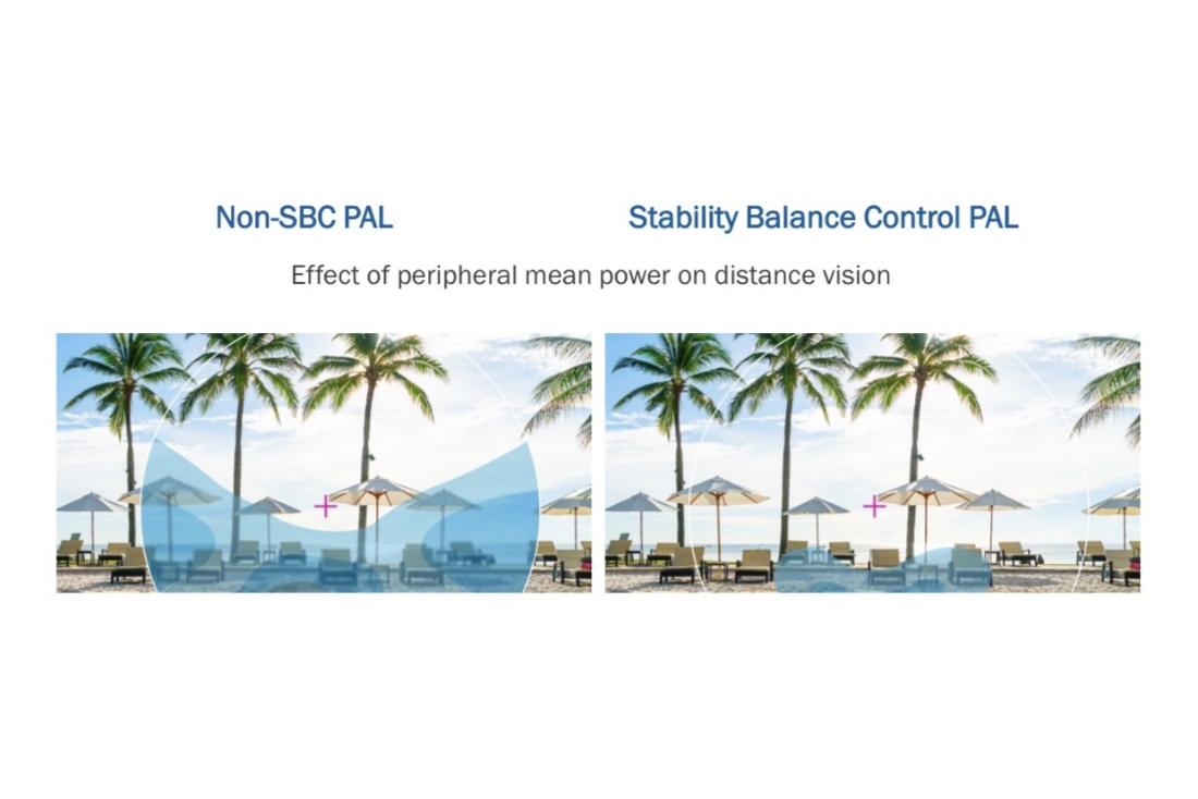 standard toric lens and DLT graph